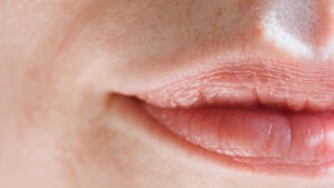 alimente, colagen, piele, sanatate