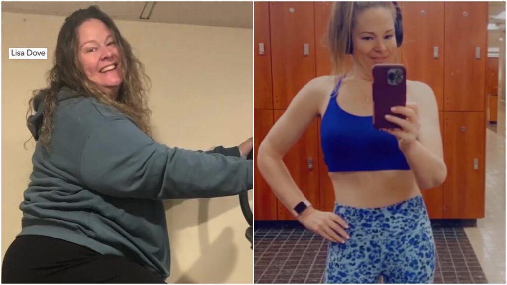 femeie, slabit, lisa love, diabet