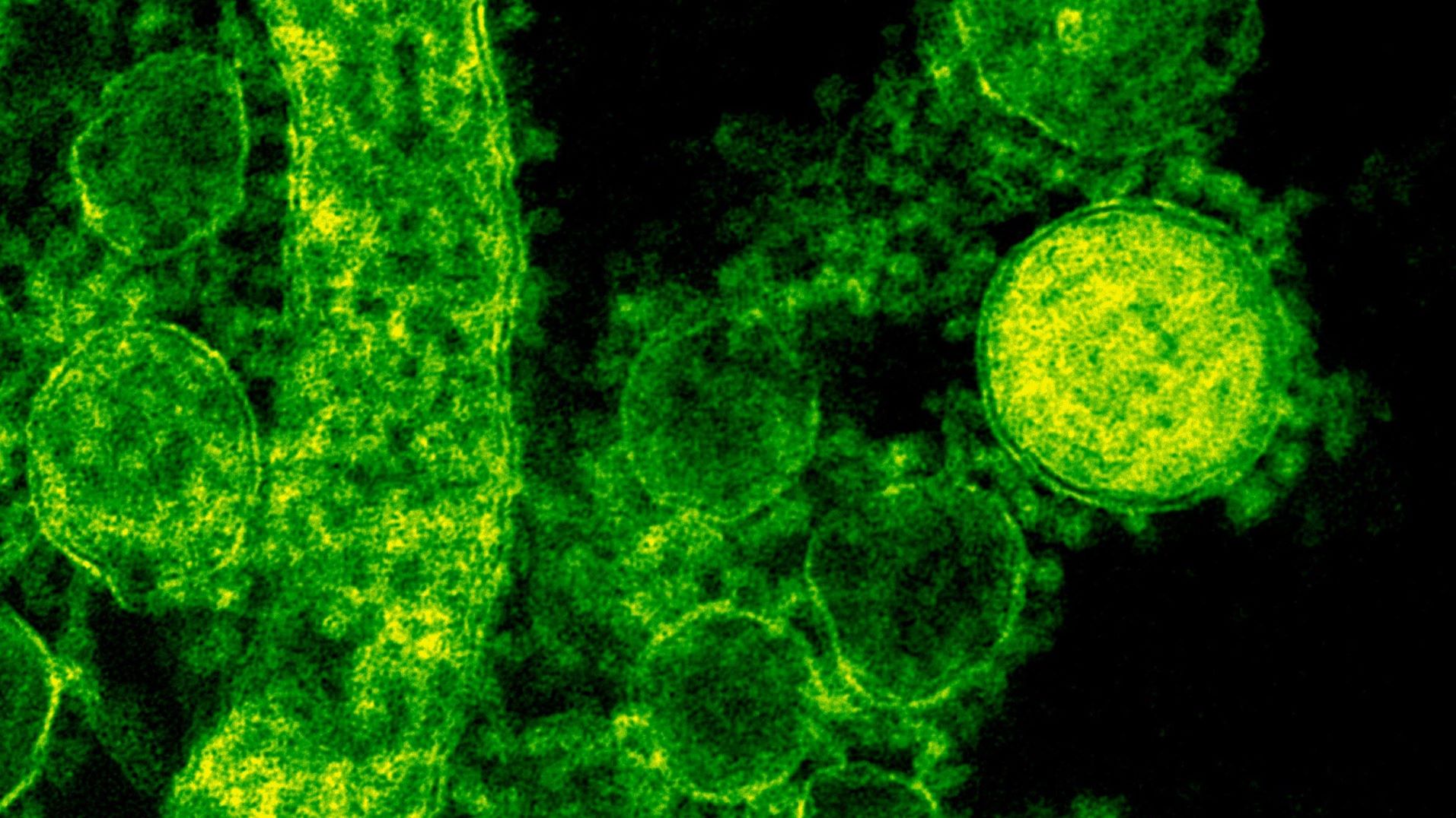 Nou trilog european pentru noile tehnici genomice.