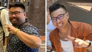 colak care arata un barbat inainte si dupa ce a slabit