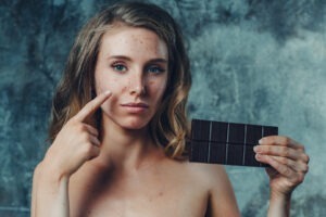 Dulciurile cauzează acnee